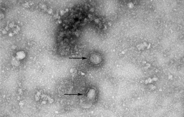 Việt Nam nuôi cấy và phân lập thành công virus corona chủng mới