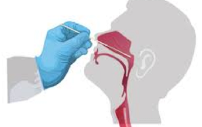 CDC Hà Nội hướng dẫn người dân dùng test nhanh vi rút SARS-CoV-2 tại nhà
